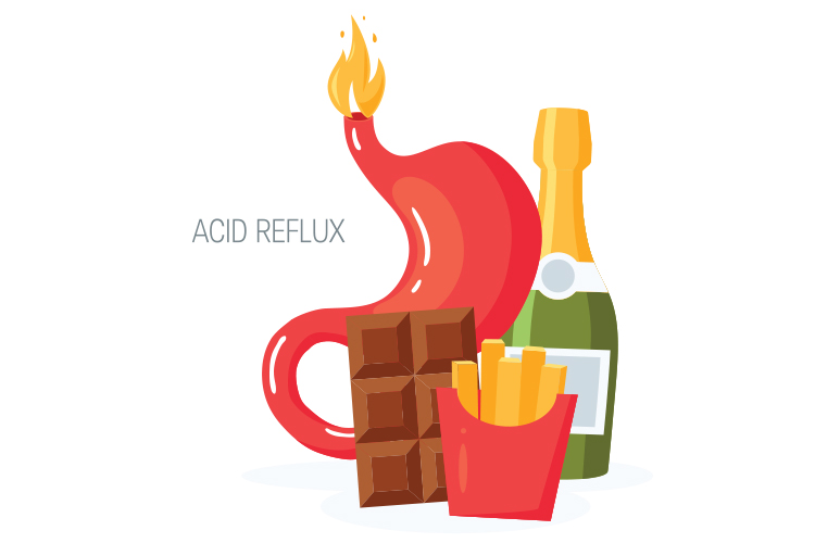 Natural Remedies for Acid Reflux